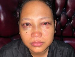 Istri di Kabun Babak Belur Dihajar Suami Gegara Cemburu