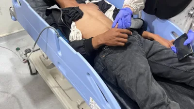 Diduga Dipukul dan Dilempari Batu, Warga Limapuluh Kota Resmi Lapor ke Polresta Bukittinggi
