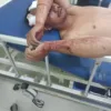 Ditemukan Babak Belur di Gelanggang Pacu Kuda Bukit Ambacang, Diduga Jadi Korban Pengeroyokan