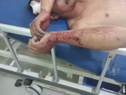 Ditemukan Babak Belur di Gelanggang Pacu Kuda Bukit Ambacang, Diduga Jadi Korban Pengeroyokan